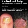 Fungal Infections of the Nail and Scalp: The Current Approach to Diagnosis and Therapy, 3rd Edition (EPUB)