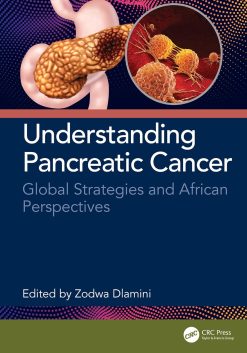 Understanding Pancreatic Cancer: Global Strategies and African Perspectives (Original PDF from Publisher)