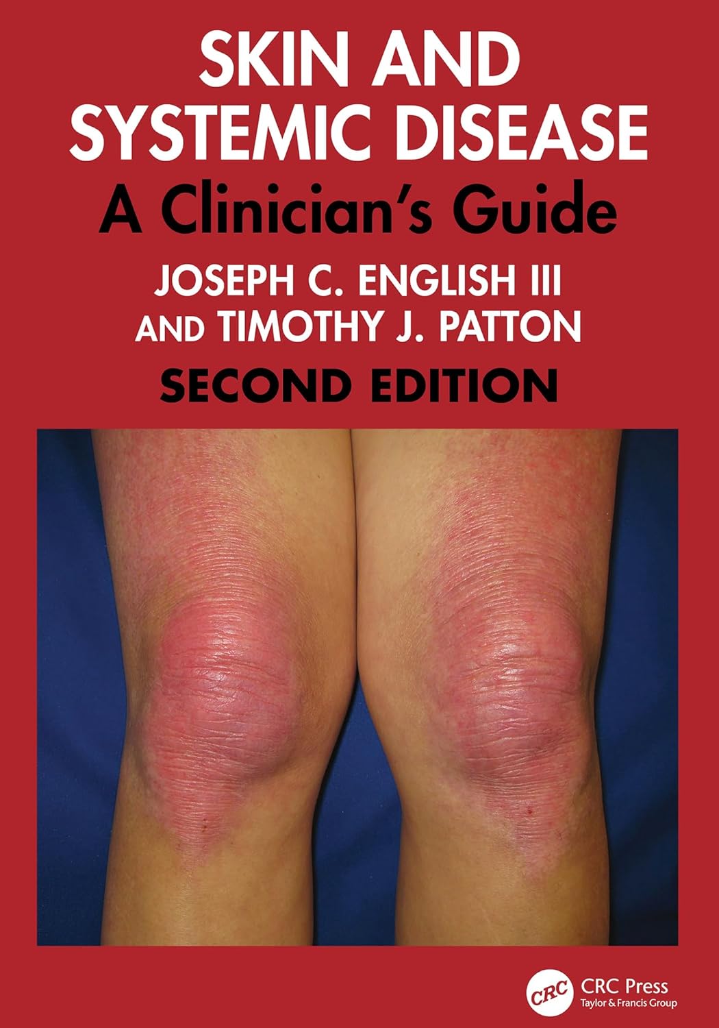 Skin and Systemic Disease: A Clinician’s Guide, 2nd Edition (EPUB)