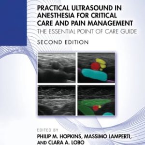 Practical Ultrasound in Anesthesia for Critical Care and Pain Management, 2nd Edition (EPUB)