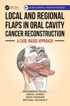 Local and Regional Flaps in Oral Cavity Cancer Reconstruction: A case-based approach (EPUB)