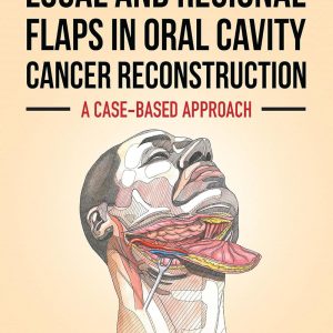 Local and Regional Flaps in Oral Cavity Cancer Reconstruction: A case-based approach (EPUB)