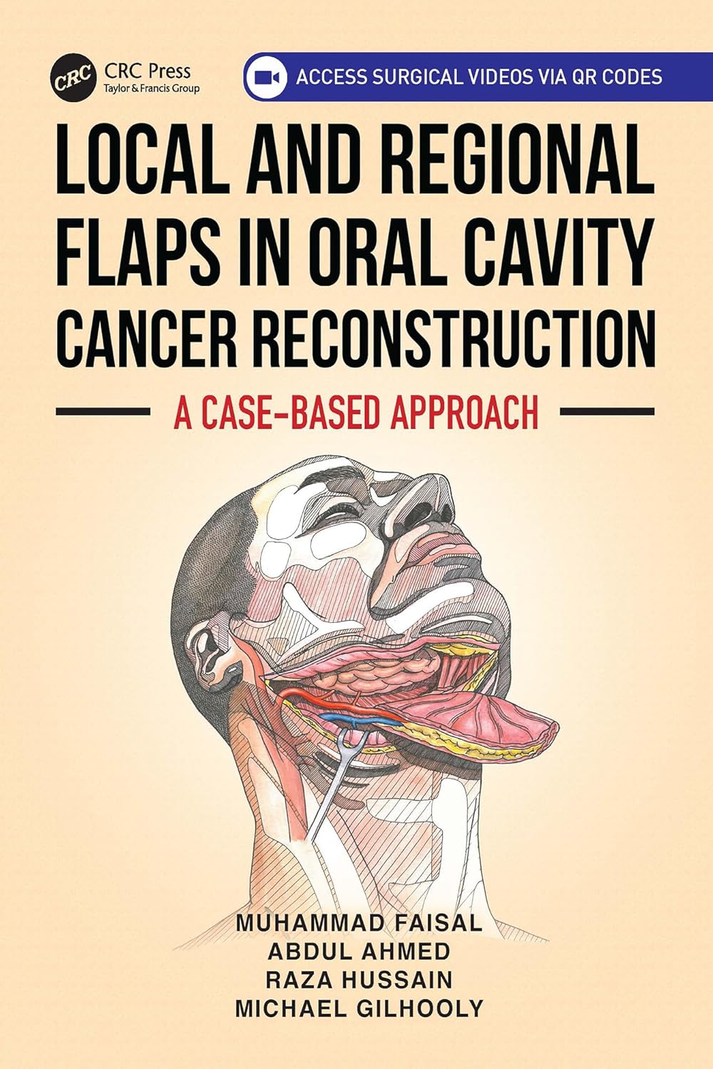 Local and Regional Flaps in Oral Cavity Cancer Reconstruction: A case-based approach (EPUB)
