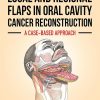 Local and Regional Flaps in Oral Cavity Cancer Reconstruction: A case-based approach (Original PDF from Publisher)