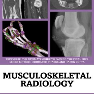 Musculoskeletal Radiology (EPUB)