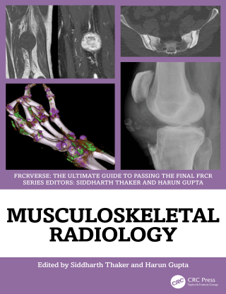 Musculoskeletal Radiology (EPUB)