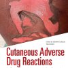 Cutaneous Adverse Drug Reactions: A Case Based Approach for Deeply Pigmented Skin (Series in Dermatological Treatment) (EPUB)