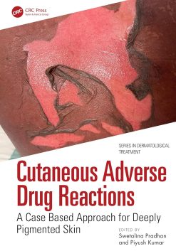 Cutaneous Adverse Drug Reactions: A Case Based Approach for Deeply Pigmented Skin (Series in Dermatological Treatment) (EPUB)