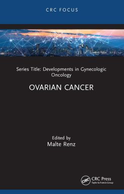 Ovarian Cancer (Original PDF from Publisher)