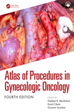 Atlas of Procedures in Gynecologic Oncology, 4th Edition (EPUB)