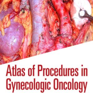 Atlas of Procedures in Gynecologic Oncology, 4th Edition (EPUB)