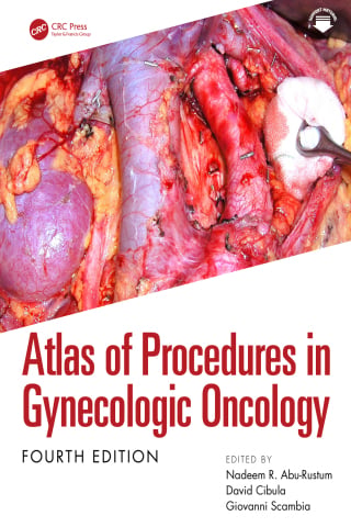 Atlas of Procedures in Gynecologic Oncology, 4th Edition (EPUB)