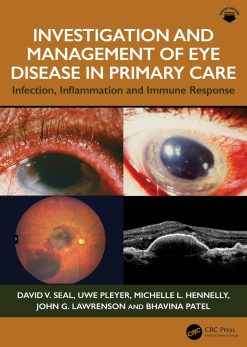 Investigation & Management of Eye Disease in Primary Care: Infection, Inflammation and Immune Response (EPUB)