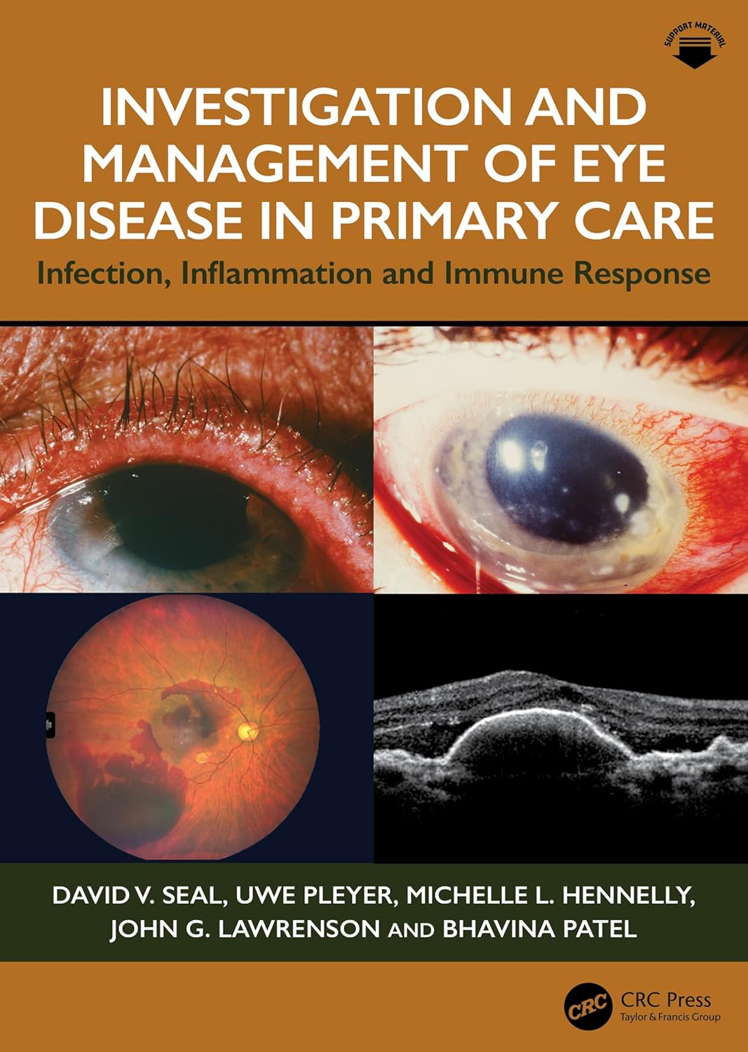 Investigation & Management of Eye Disease in Primary Care: Infection, Inflammation and Immune Response (Original PDF from Publisher)
