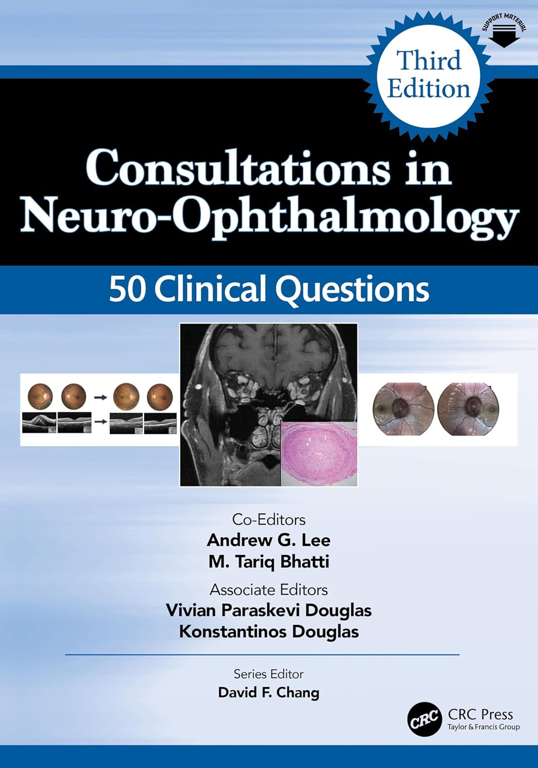 Consultations in Neuro-Ophthalmology: 50 Clinical Questions (Curbside Consultation in Ophthalmology), 3rd Edition (Original PDF from Publisher)