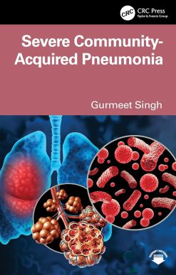 Severe Community-Acquired Pneumonia (Original PDF from Publisher)