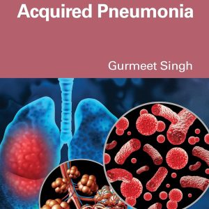 Severe Community-Acquired Pneumonia (Original PDF from Publisher)