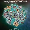 Ultrastructural Imaging of COVID-19 (EPUB)