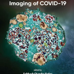 Ultrastructural Imaging of COVID-19 (EPUB)