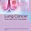 Lung Cancer (EPUB)