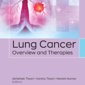Lung Cancer (EPUB)