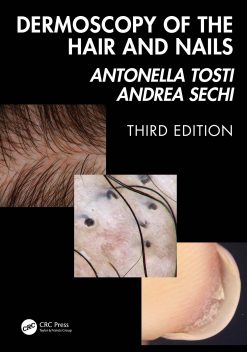 Dermoscopy of the Hair and Nails, 3rd Edition (EPUB)