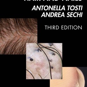 Dermoscopy of the Hair and Nails, 3rd Edition (EPUB)