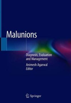 Malunions: Diagnosis, Evaluation and Management (Original PDF from Publisher)