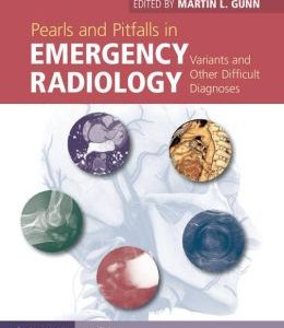 Pearls and Pitfalls in Emergency Radiology: Variants and Other Difficult Diagnoses