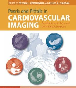 Pearls and Pitfalls in Cardiovascular Imaging: Pseudolesions, Artifacts, and Other Difficult Diagnoses