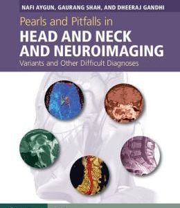 Pearls and Pitfalls in Head and Neck and Neuroimaging: Variants and Other Difficult Diagnoses (ORIGINAL PDF from Publisher)
