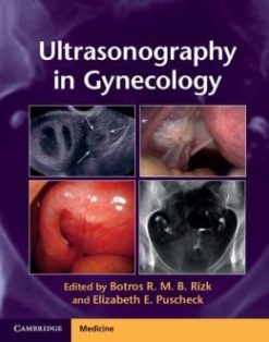 Ultrasonography in Gynecology (Original PDF from Publisher)