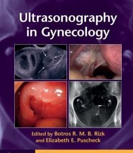 Ultrasonography in Gynecology (Original PDF from Publisher)