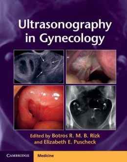 Ultrasonography in Gynecology (Original PDF from Publisher)