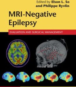 MRI-Negative Epilepsy: Evaluation and Surgical Management (ORIGINAL PDF from Publisher)