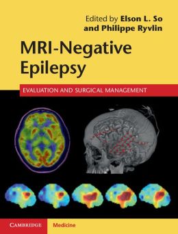 MRI-Negative Epilepsy: Evaluation and Surgical Management (ORIGINAL PDF from Publisher)