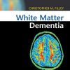 White Matter Dementia