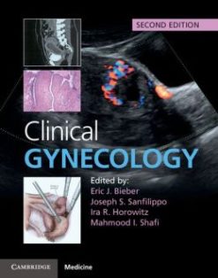 Clinical Gynecology, 2nd Edition