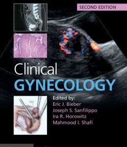 Clinical Gynecology, 2nd Edition