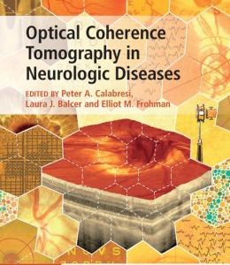 Optical Coherence Tomography in Neurologic Diseases