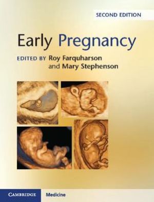 Early Pregnancy, 2nd Edition (Original PDF)