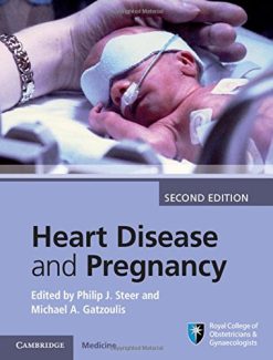 Heart Disease and Pregnancy, 2nd Edition