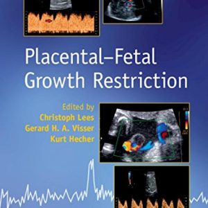 Placental-Fetal Growth Restriction (PDF)