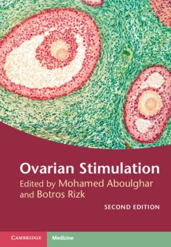 Ovarian Stimulation, 2nd Edition (Original PDF from Publisher)