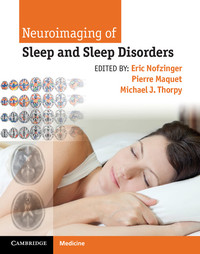 Neuroimaging of Sleep and Sleep Disorders (Original PDF from Publisher)