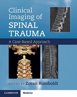 Clinical Imaging of Spinal Trauma: A Case-Based Approach (Original PDF from Publisher)