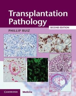 Transplantation Pathology, 2nd Edition (Original PDF from Publisher)