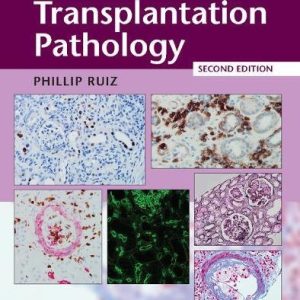 Transplantation Pathology, 2nd Edition (Original PDF from Publisher)