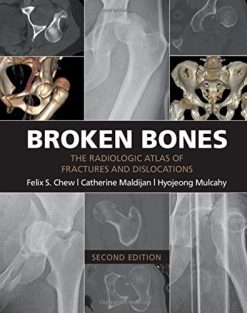 Broken Bones: The Radiologic Atlas of Fractures and Dislocations