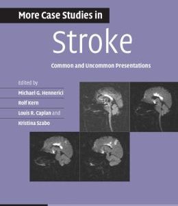 More Case Studies in Stroke: Common and Uncommon Presentations